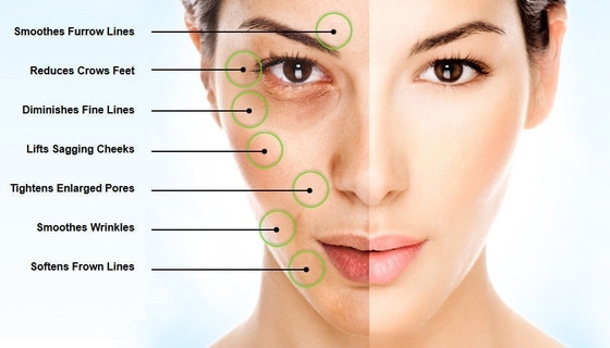 غسول الجسم مسحوق حمض الهيالورونيك كاس 9067-32-7 المواد الخام التجميلية